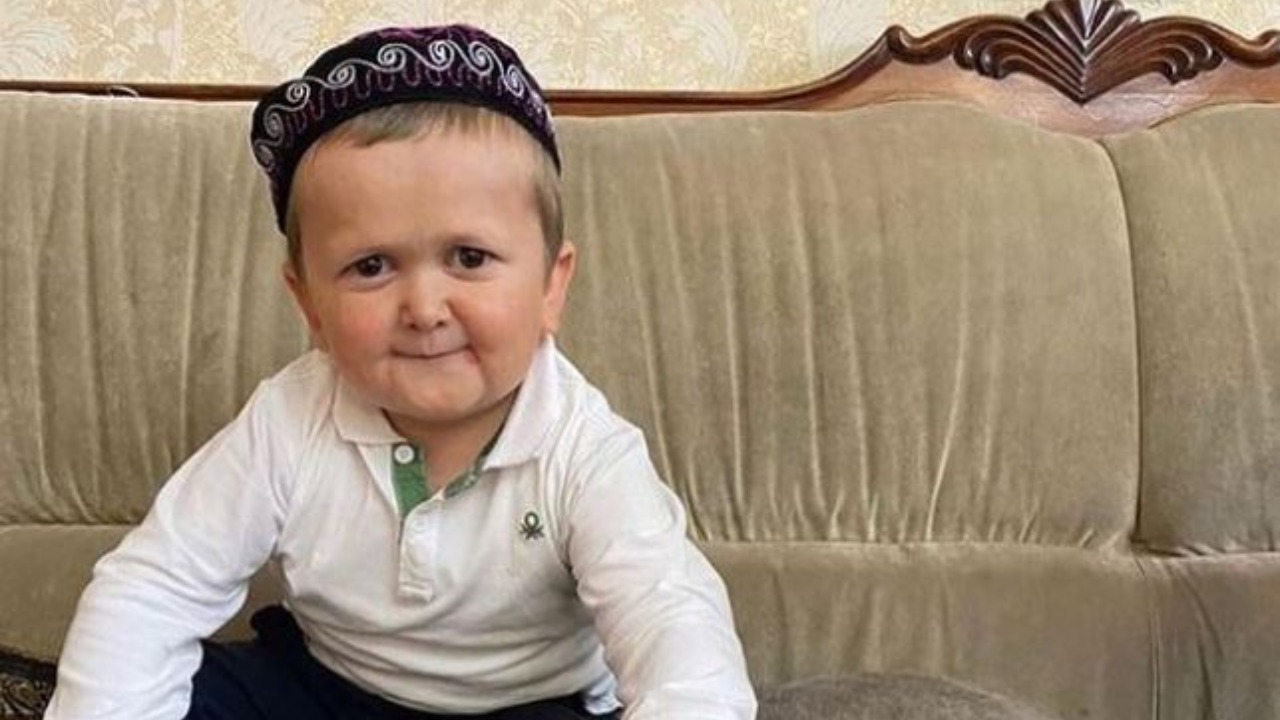Hasbula je internet senzacija iza koje se krije tužna priča! 1 ksps78i3 169