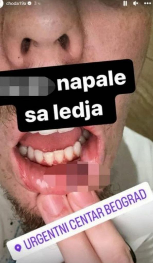 Choda