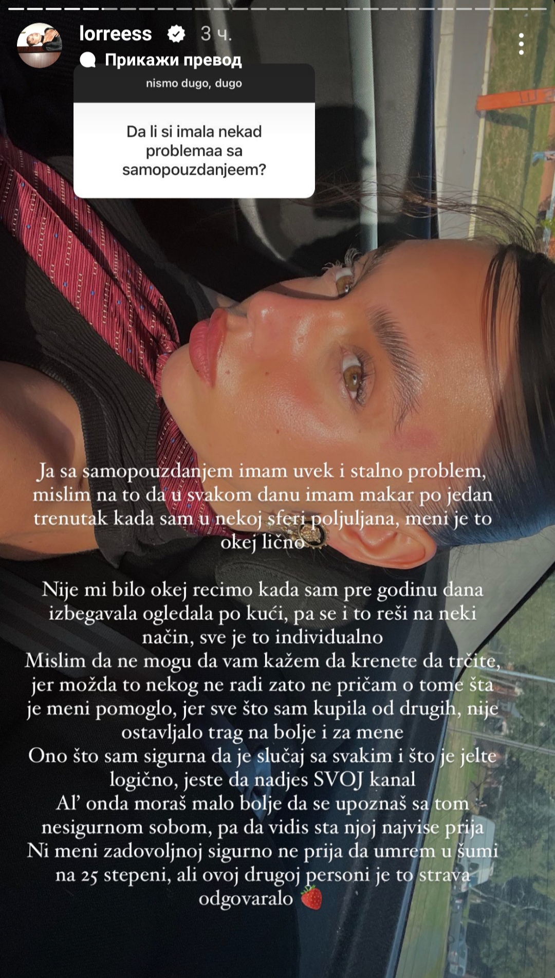 "Sa samopouzdanjem uvek imam problem": Lores iskreno progovorila o svojim nesigurnostima, pa uputila svima važne savete 2 1708075592384