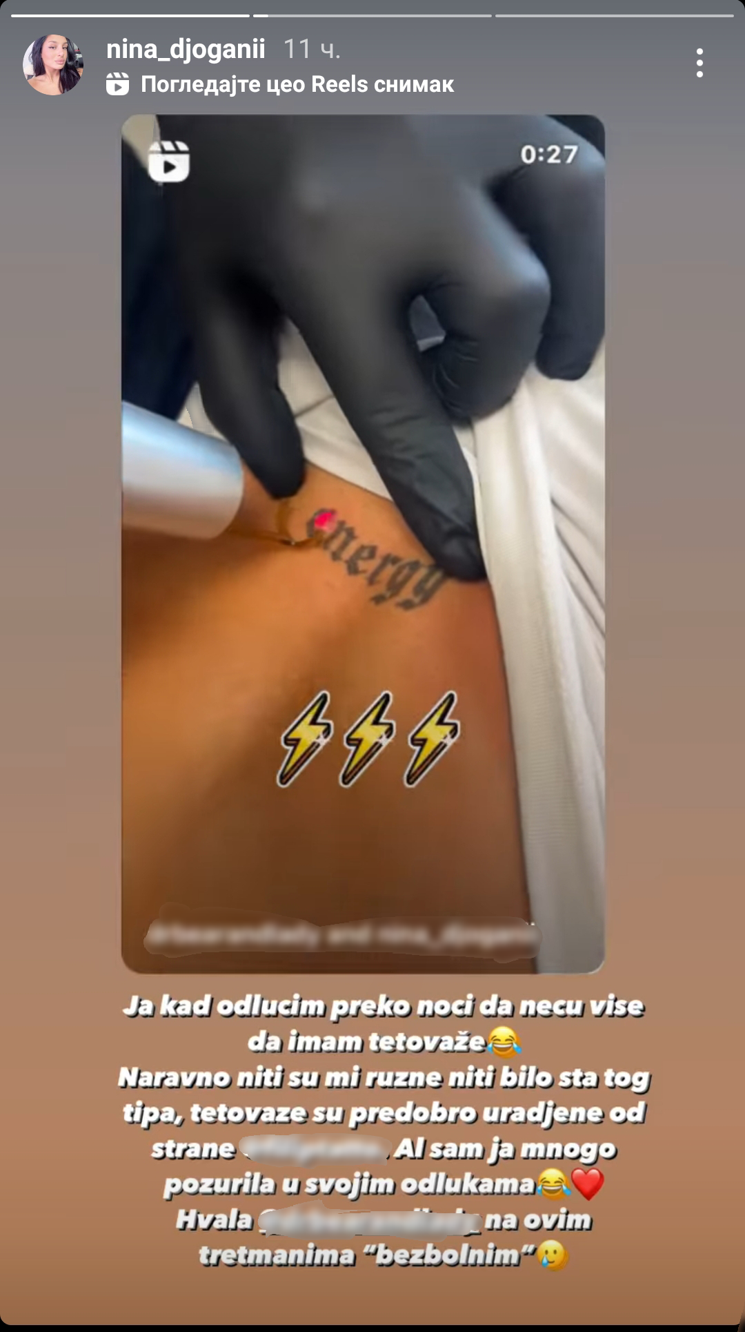„Požurila sam u svojim odlukama“: Nina Đogani se pokajala zbog tetovaže, pa napravila važan korak (FOTO) 2 Photo 1709799558250