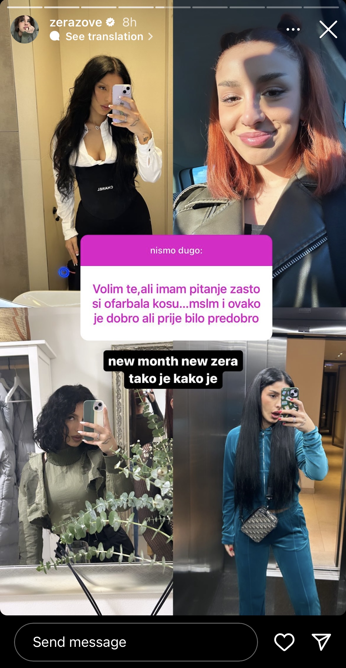 "Nov mesec, nova Zera!" Pevačica pokazala potpuno drugačiji izgled, pa otkrila kroz koje sve transformacije je prošla (FOTO) 2 IMG 1742