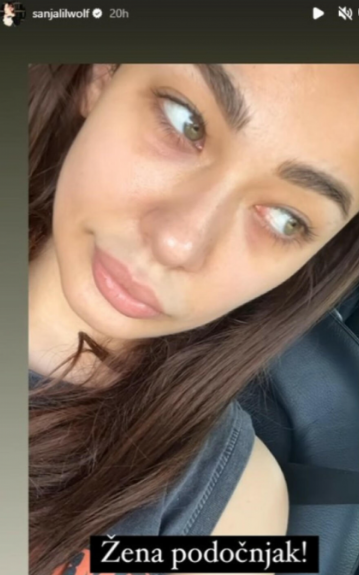 Naše popularne pevačice u izdanju u kom ih retko viđamo: Pokazale kako izgledaju bez šminke, pa potezom oduševile fanove (FOTO) 2 Screenshot 2024 04 30 150952