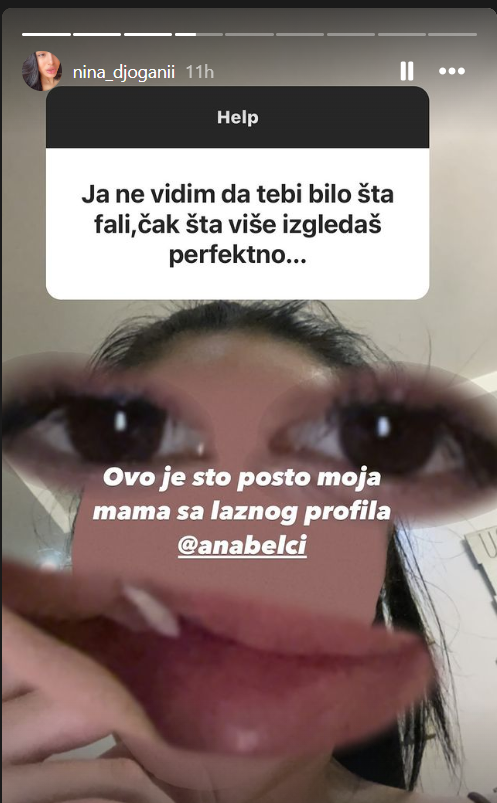 Nina Đogani pokazala kako je nekada izgledala: Razlika u kilaži je i više nego očigledna (FOTO) 3 image 2024 05 01 094847836