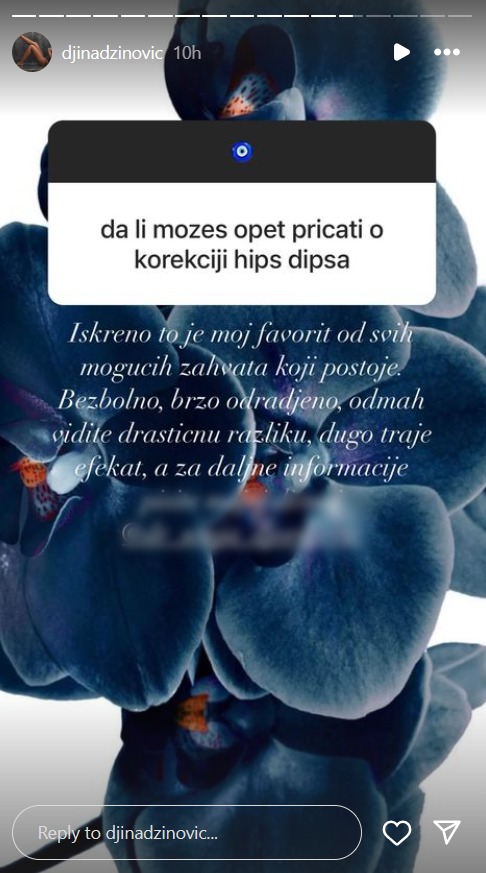 Progovorila o estetskim korekcijama: Đina Džinović ne krije šta je radila na sebi, otkrila koji zahvat joj je omiljen (FOTO) 2 blur photo.com 1717657964