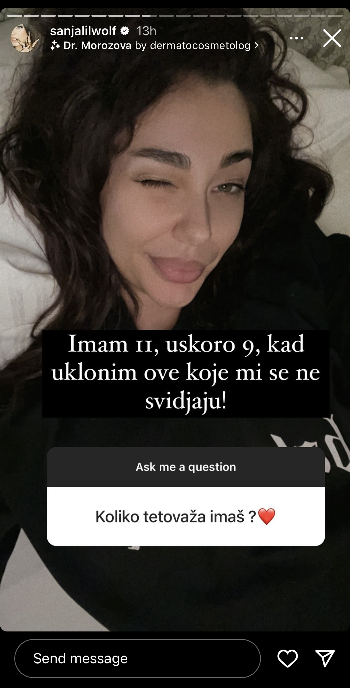Spremna na drastičan korak! Sanja Vućič otkrila šta će promeniti na sebi, pa se pridružila brojnim zvezdama koje su se odlučile na ovaj potez 2 IMG 8313