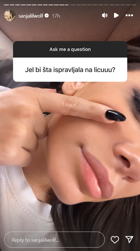 Sanja Vučić otkrila koju estetsku korekciju planira, pa priznala šta NIKADA ne bi operisala: "Smatram da je to moj šmek" 2 Screenshot 2024 10 10 145154