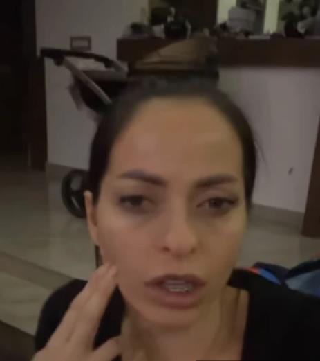 "Imam podliv, peče me jako": Katarina Lazić posetila estetskog hirurga, pa otkrila sve detalje procedure, a evo šta će sledeće raditi na sebi 2 2160145