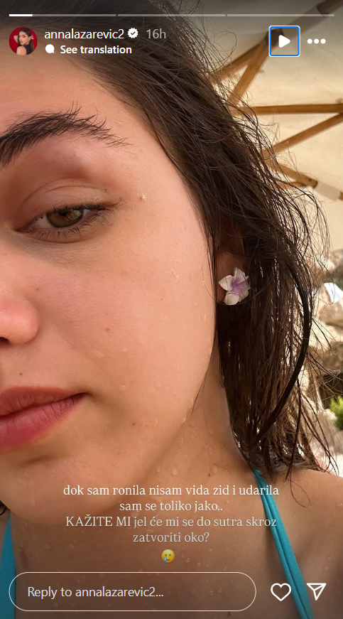 "Nisam videla zid i udarila sam se jako": Naša popularna influenserka doživela nezgodu na putovanju, pa otkrila sve o povredi (FOTO) 2 Screenshot 2025 05 27 092222
