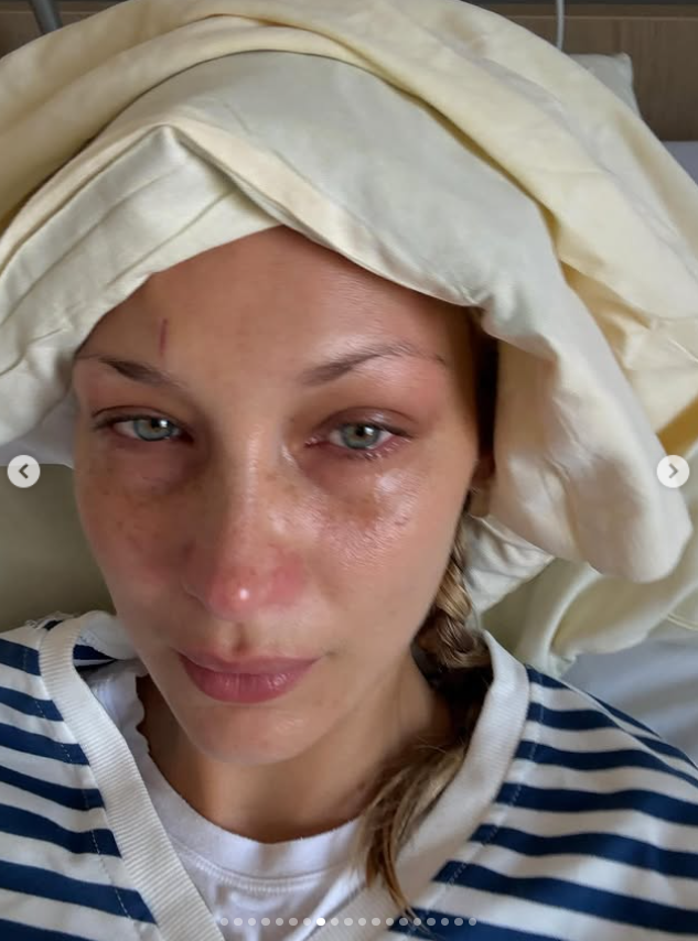 Bela Hadid otkrila detalje zdravstvenih problema: "Trpela sam jake bolove" 2 Screenshot 2025 09 18 145242